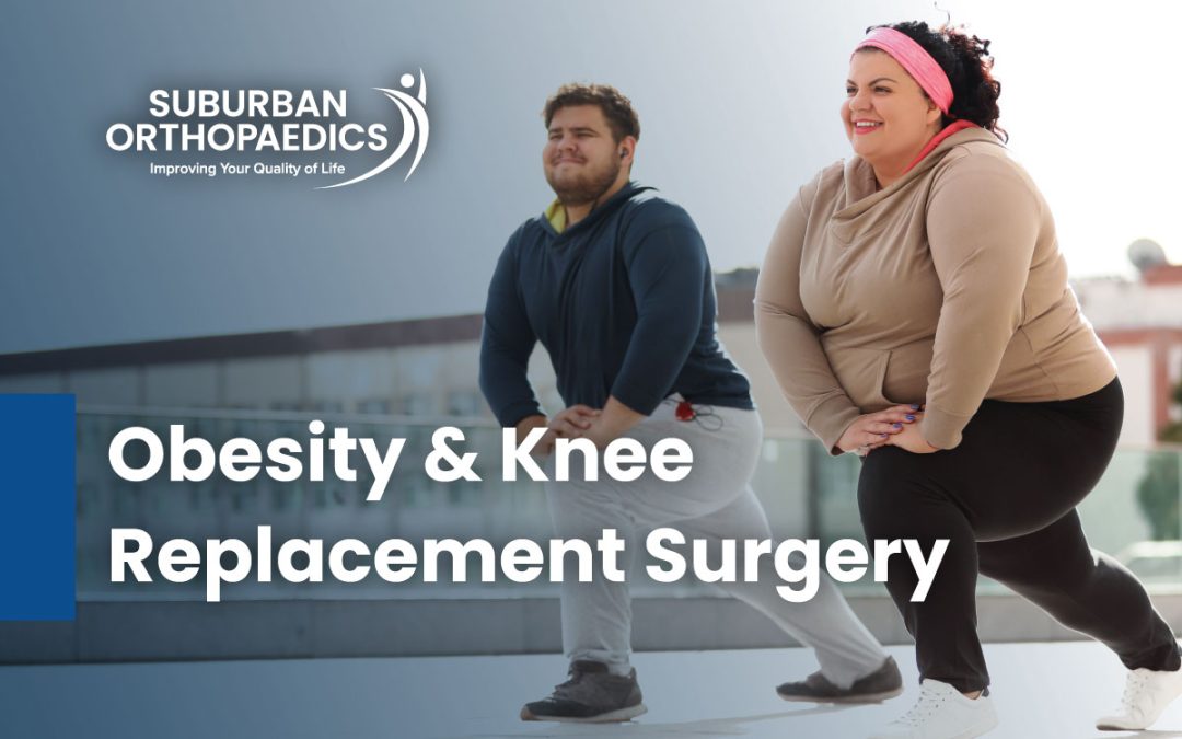 Obesity and Knee Replacement Surgery