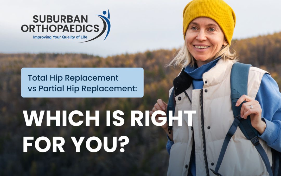 Total Hip Replacement vs Partial Hip Replacement: Which Is Right for You?