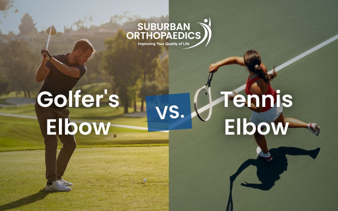 Golfer’s Elbow vs. Tennis Elbow: What’s the Difference and How Are They Treated?