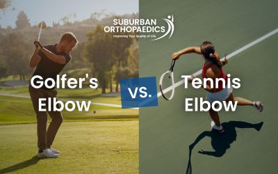 Golfer’s Elbow vs. Tennis Elbow: What’s the Difference and How Are They Treated?