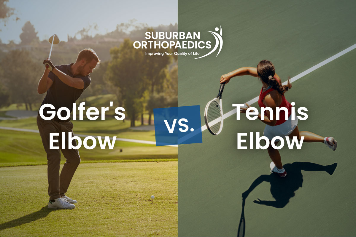 Golfer's Elbow vs. Tennis Elbow What's the Difference and How Are They Treated